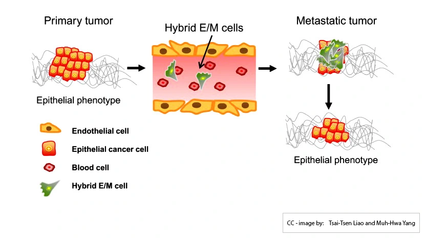 MCBeng EMT and MET while metastasis